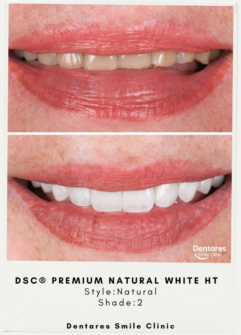DSC-3-Premium-Natural-White