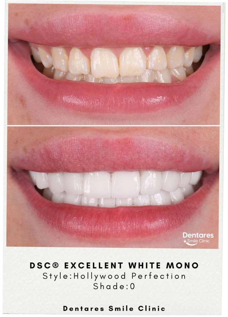 DSC-Excellent-White-Mono-1