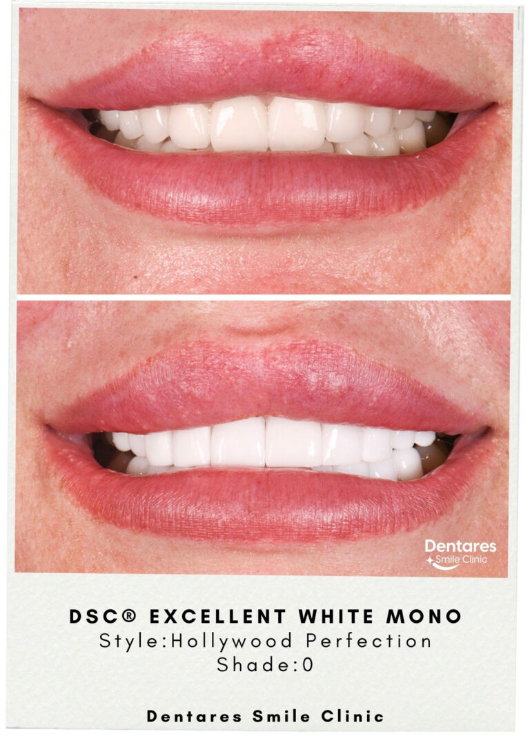 DSC-Excellent-White-Mono-2