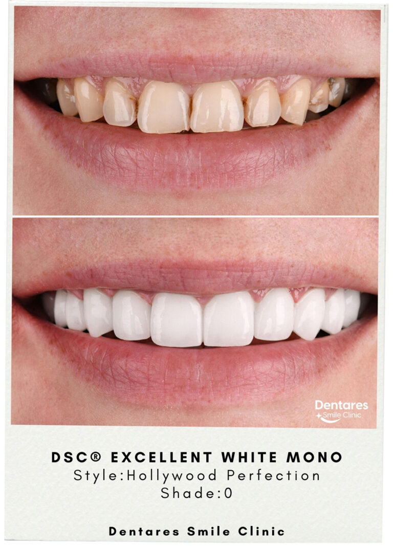 DSC-Excellent-White-Mono-3