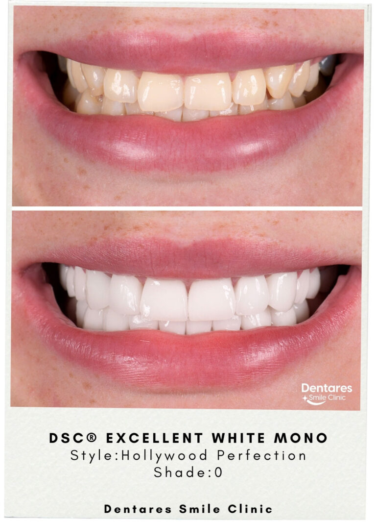 DSC-Excellent-White-Mono-4