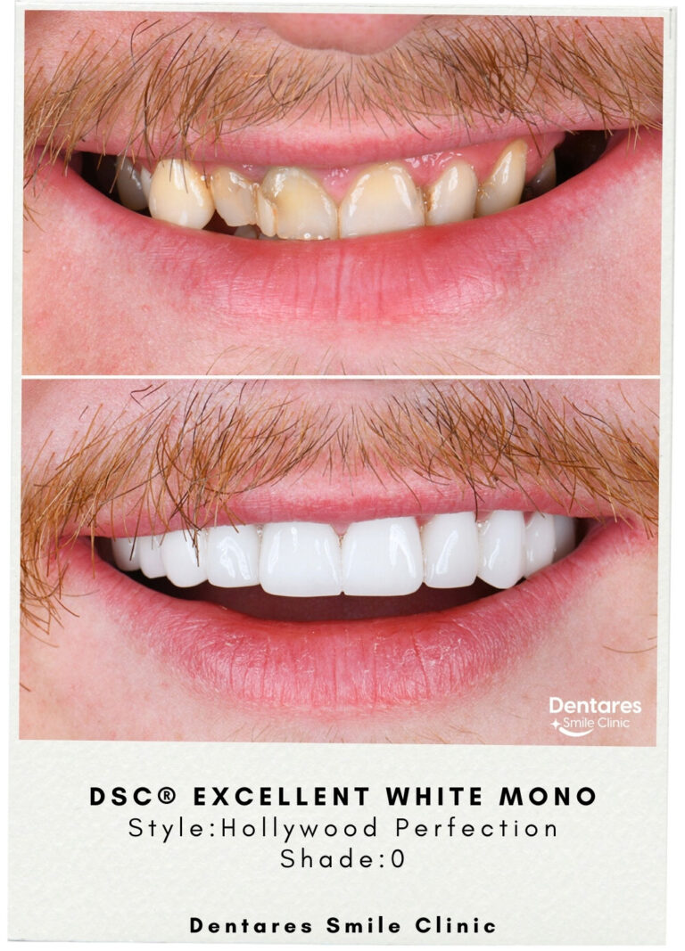 DSC-Excellent-White-Mono-5