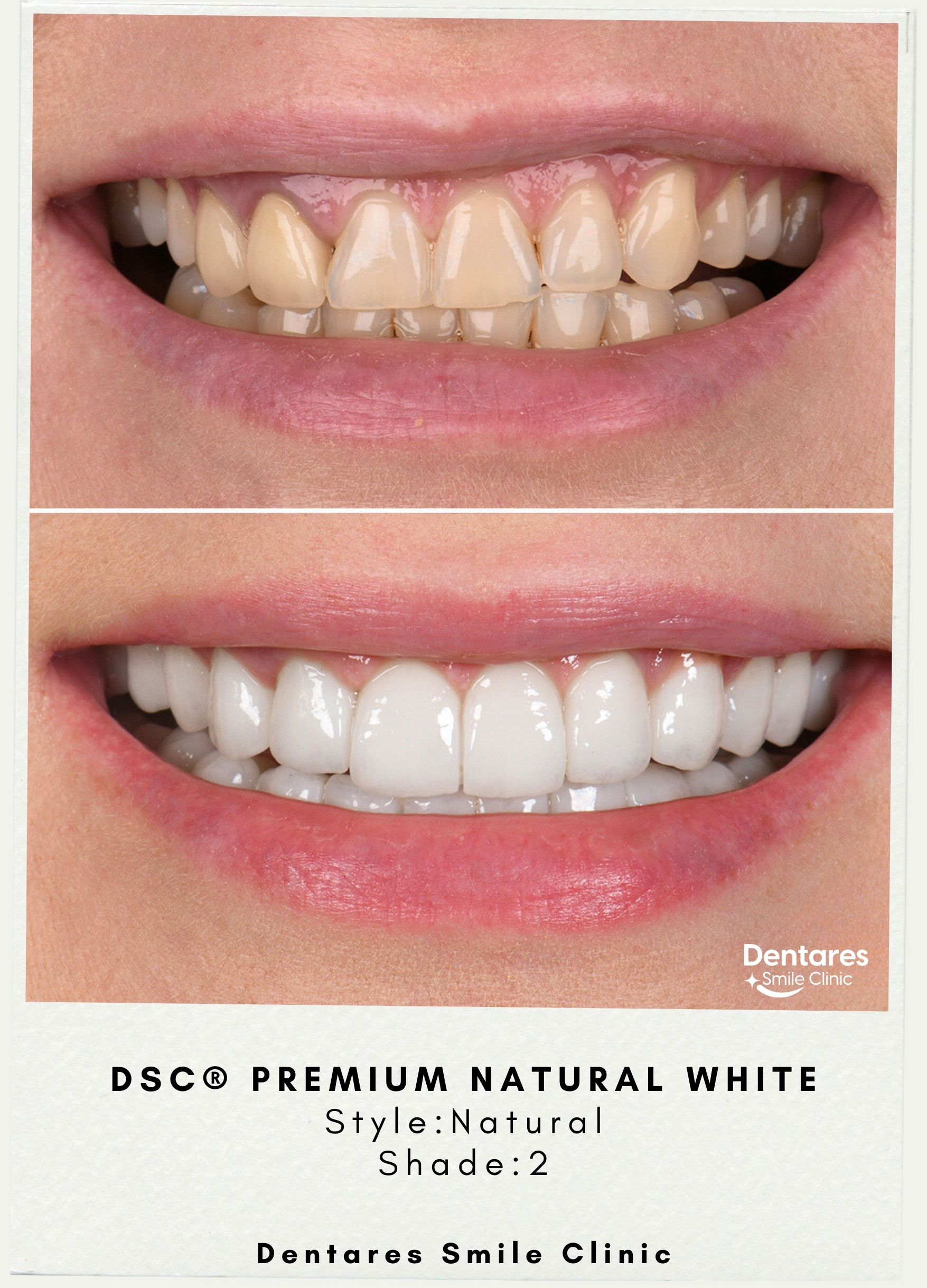 DSC-Premium-Natural-White-Style-Natural-Shade2-1