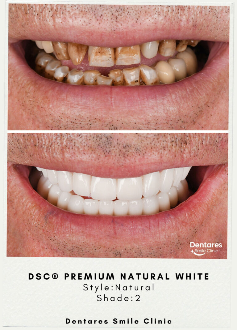 DSC-Premium-Natural-White-Style-Natural-Shade2-2