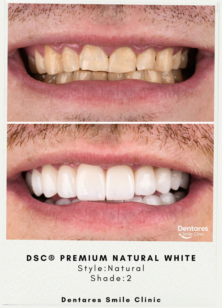 DSC-Premium-Natural-White-Style-Natural-Shade2-3