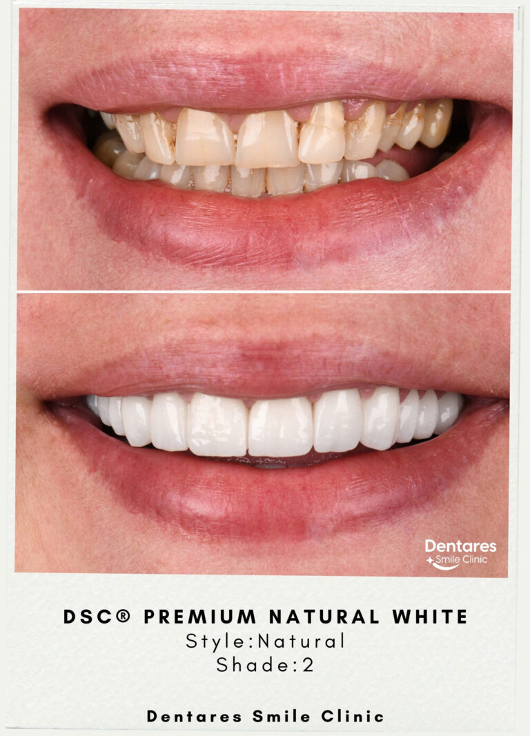 DSC-Premium-Natural-White-Style-Natural-Shade2-4
